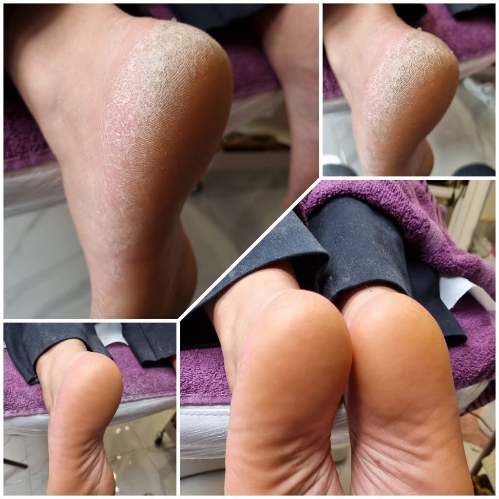 Medicinski i estetski pedikir